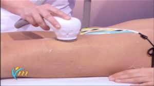 Presentazione dell’apparecchiatura BODYKA PLUS- video esterno